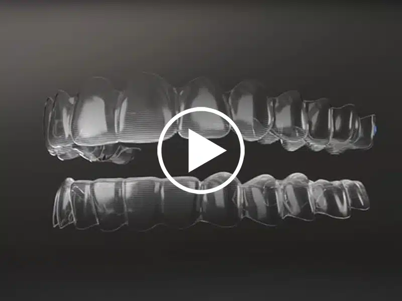Invisalign-Teen-Video-Cover-800